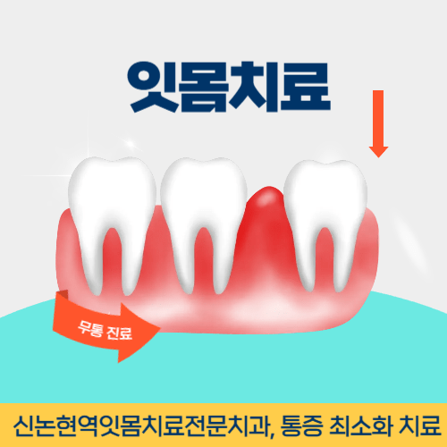 양산치과 양산시 치과 잇몸치료